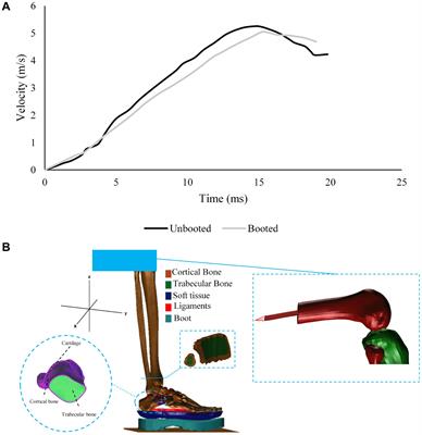 An Experimentally Validated Finite Element Model of the Lower Limb to Investigate the Efficacy of Blast Mitigation Systems